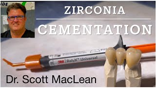 Zirconia Cementation with RelyX Universal Cement  Dr Scott MacLean  Dentist [upl. by Salomo]