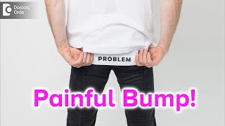 Painful bump on buttocks Causes Symptoms amp Treatment  Dr Rajdeep Mysore  Doctors Circle [upl. by Maxentia]