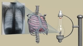 History of Computerized Tomography CT Scanner [upl. by Ilario916]