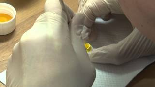 How to Make a Zirconia Crown [upl. by Nerek]