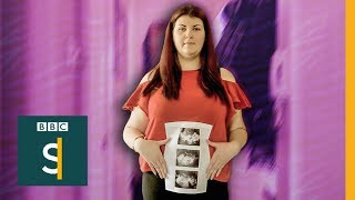 Womens Health PCOS condition without a cure  BBC Stories [upl. by Adriene379]