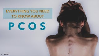 Everything You Need To Know About PCOS  Causes Symptoms Treatments [upl. by Aibar]