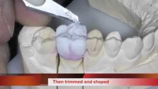 How we make a Zirconia Crown [upl. by Enahs]