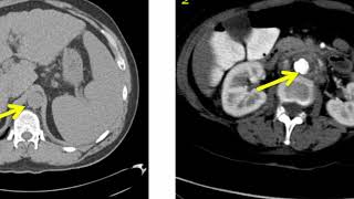 Introduction to Radiology Computed Tomography [upl. by Eimaral]