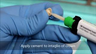 Bonding a zirconia crown [upl. by Derward]