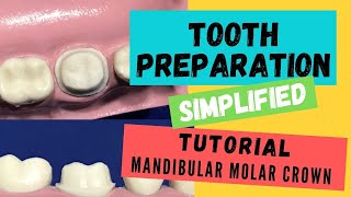 Zirconia Crown Preparation DEMONSTRATION Super Simplified [upl. by Anerda]