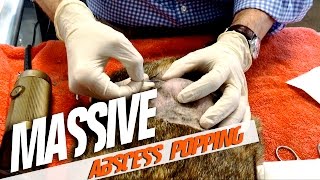 Massive Abscess Popping [upl. by Wain269]