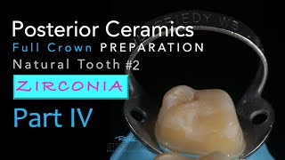 Zirconia Ceramics Part 4 AllCeramic Crown Preparation 2 Natural Tooth [upl. by Hermie]