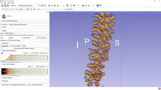 Tracked ultrasound AI segmentation and 3D reconstruction tutorial [upl. by Marcela]