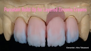 Porcelain Build Up for Layered Zirconia Crowns [upl. by Akered]