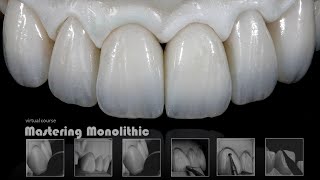 Mastering Monolithic Zirconia IN ENGLISH [upl. by Leterg]