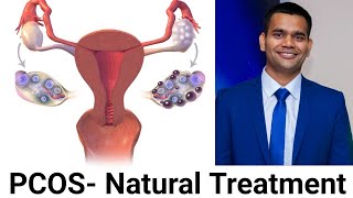 Natural way to treat Polycystic ovarian syndrome PCOSPCOD  Dr Vivek Joshi [upl. by Nwonknu]