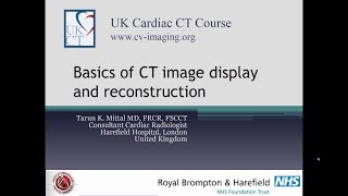 CT image display and reconstruction [upl. by Ttezzil]