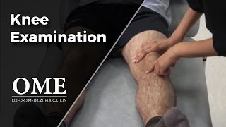 Knee Examination  Orthopaedics [upl. by Eidak]